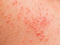 how to determine the presence of parasites in the body