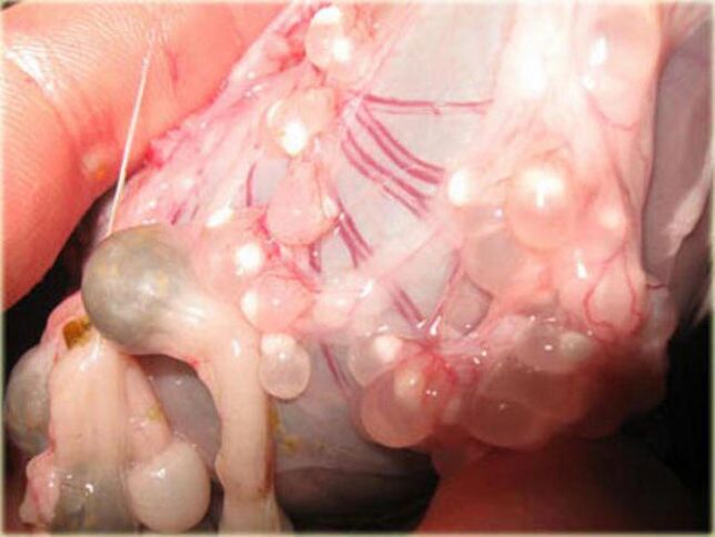 Cysticercus larvae under the skin
