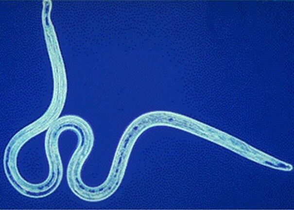 nematodes in the human body