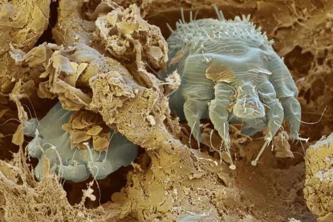 scabies mite under a microscope